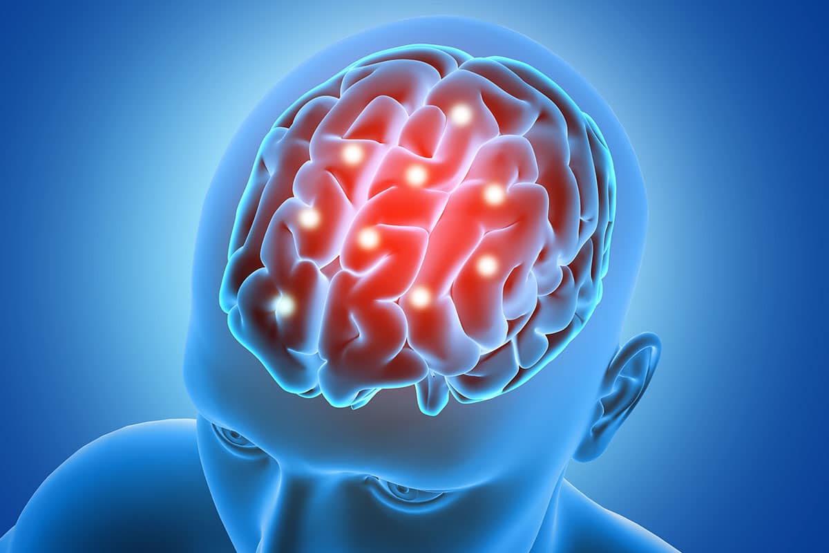 Neurologia a Palermo — TAC Nuclear